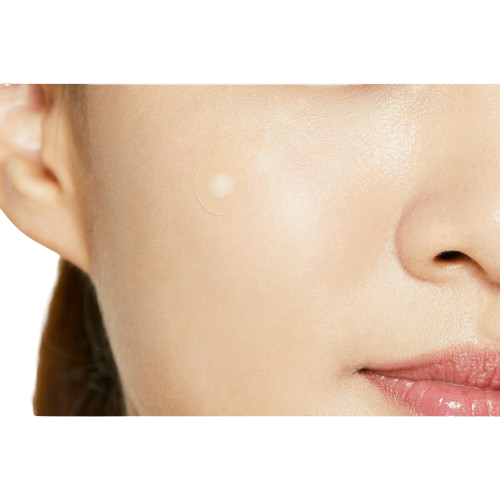 Acne Patch