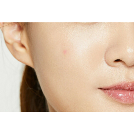 Acne Patch