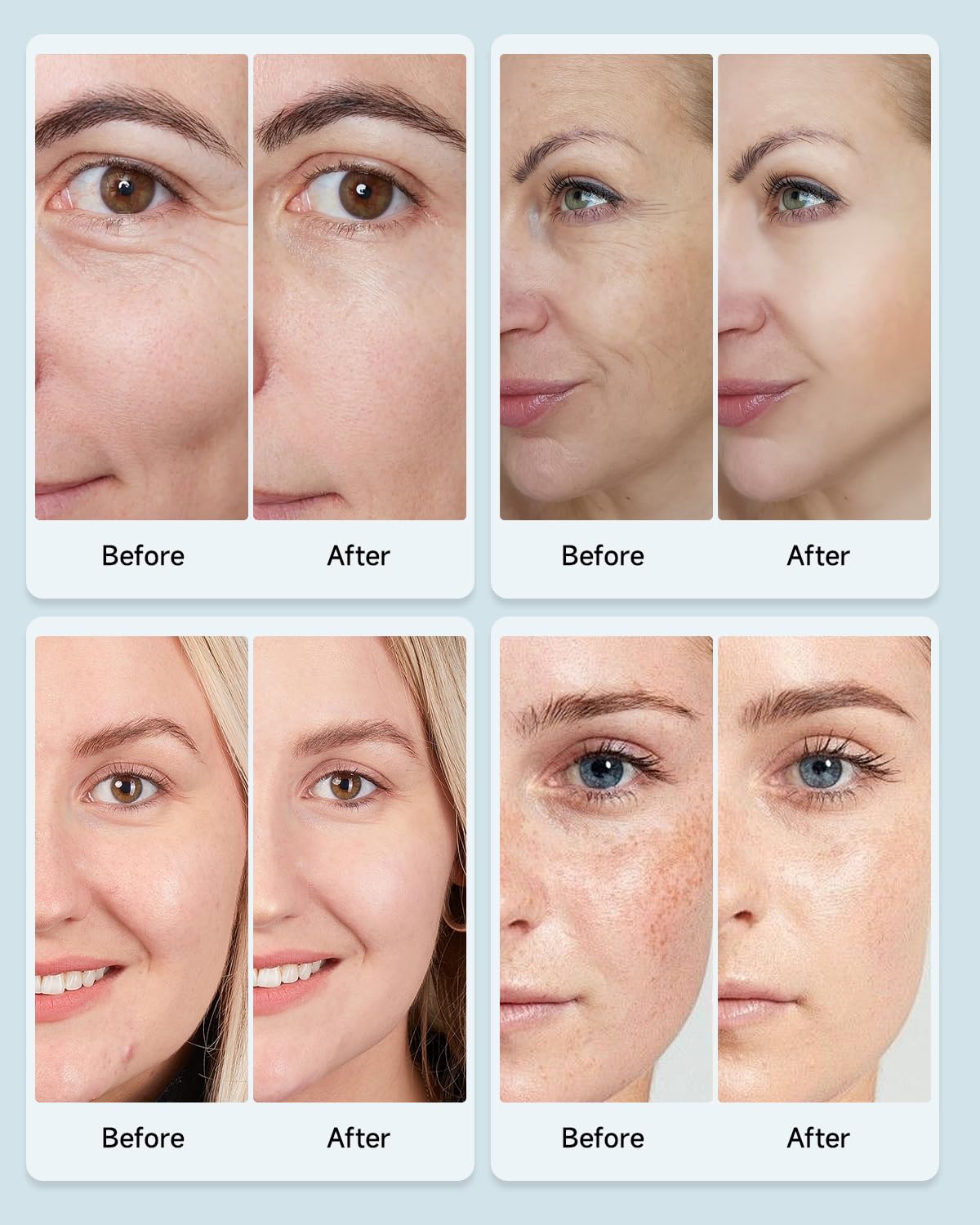 LED Face Mask - Reduce Wrinkles Today